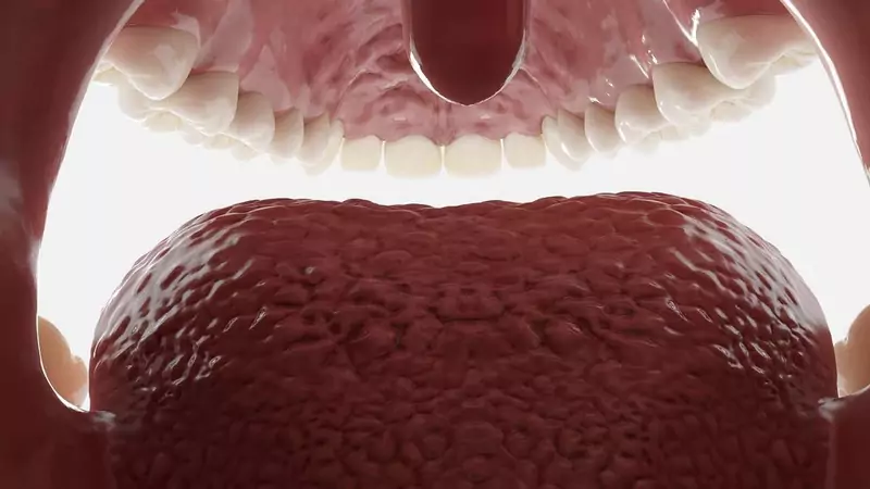 Base of Tongue Cancer