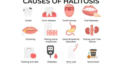 Causes of Bad Breath